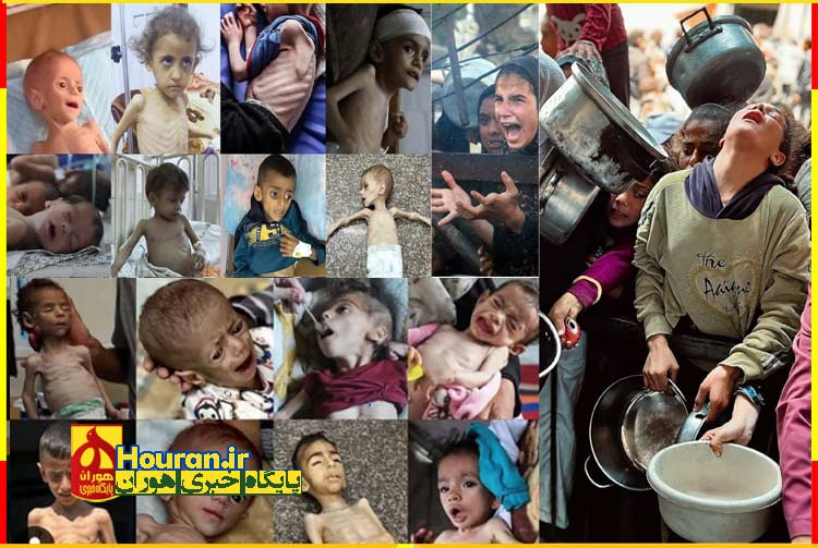 هر شهید گرسنه در غزه، سقوط دیگری از جهان انسانی اعراب است